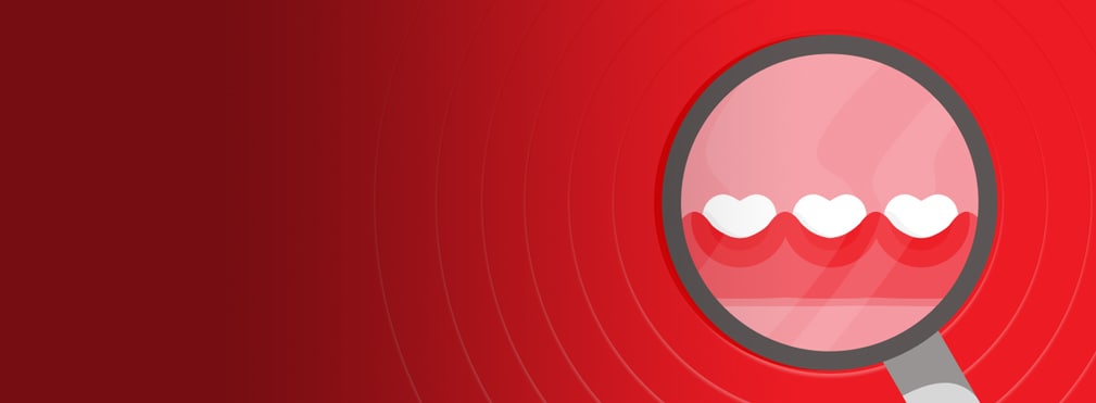 infekterat tandkött